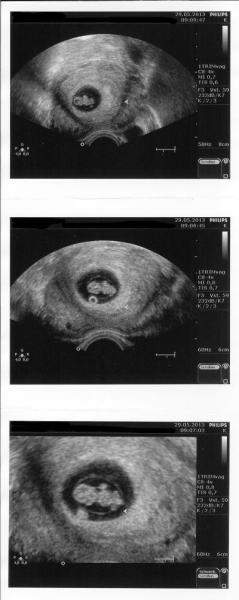 Bild zu Ultraschall-Bildchen vom FA-Termin - Forum für Januar - Mamis