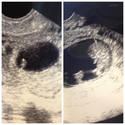 Bild zu Neues bildcheeeeennn (: - Forum für Januar - Mamis
