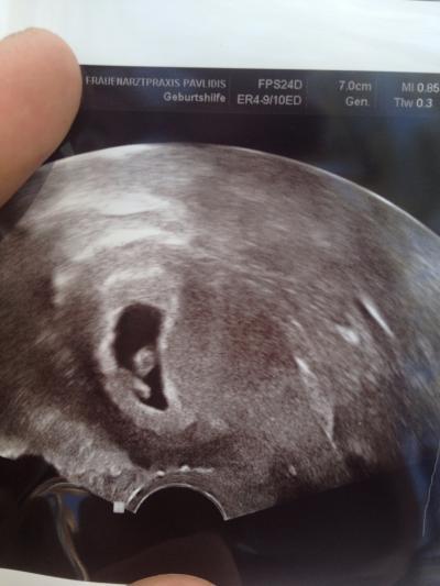 Bild zu Juhuu Baby Herz schlägt - Forum für Januar - Mamis