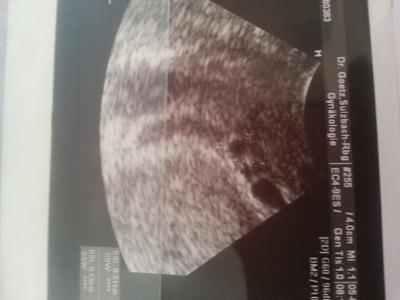 Bild zu Sooooo... Bild vom US - Forum für Januar - Mamis