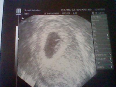 Bild zu Es wächst und wächst.. ;) - Forum für Januar - Mamis