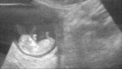 Bild zu zurück vom FA mit Bildchen - Forum für Januar - Mamis