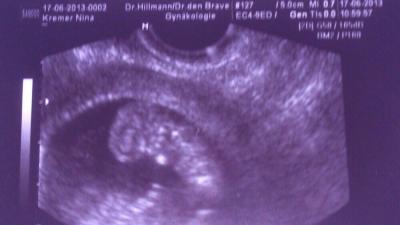 Bild zu Bildchen und Vorsorge usw. .. - Forum für Januar - Mamis