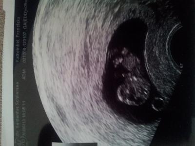 Bild zu Vom fa zurück :-) - Forum für Januar - Mamis