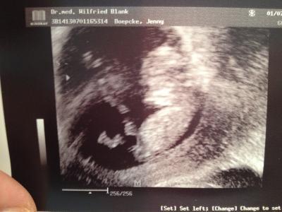 Bild zu Fa Termin vorbei - Forum für Januar - Mamis