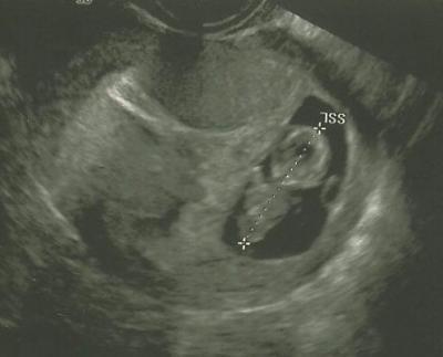 Bild zu freut ihr euch auf euer Baby ?? - Forum für Januar - Mamis