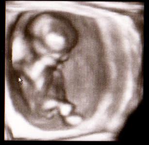 Bild zu FA Termin, Ultraschall und Co mit Bildchen :-) - Forum für Januar - Mamis