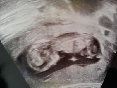 Bild zu Vorsorge bei 12+5 und Foto :) - Forum für Januar - Mamis