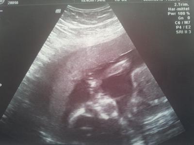 Bild zu Zurück vom FA mit Outing ! :) - Forum für Januar - Mamis