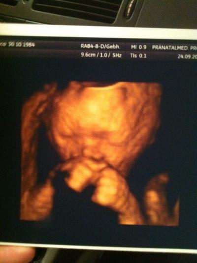 Bild zu Hier ein kleines 4D Foto von gestern... - Forum für Januar - Mamis