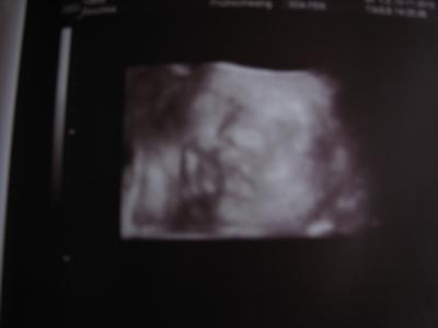 Bild zu 3.großer US und ein glücklicher Papa :) - Forum für Januar - Mamis