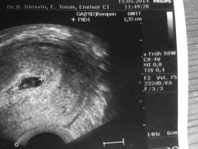 Bild zu Zurück vom FA - Forum für Januar - Mamis