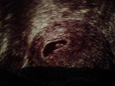 Bild zu Zurück vom Fa :) - Forum für Januar - Mamis