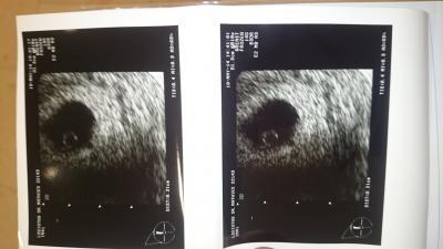 Bild zu JUHU! Das Herzchen schlägt 6+0 *-* und der Mutterpass ist auch da :D - Forum für Januar - Mamis