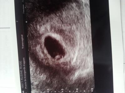 Bild zu wieder da vom FA und glücklich - Forum für Januar - Mamis