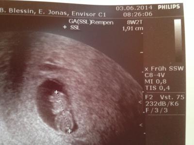 Bild zu Im Krankenhaus - Forum für Januar - Mamis