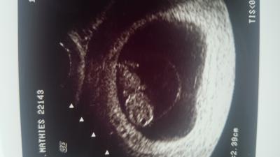 Bild zu zurück vom FA, da ist unser Krümel, heute 9+2 - Forum für Januar - Mamis