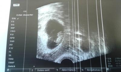 Bild zu Heute FA Termin gehabt - Forum für Januar - Mamis