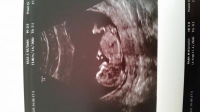 Bild zu Huhu Kugelbäuche - Forum für Januar - Mamis