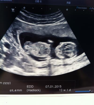 Bild zu Ersttrimester-Screening - Forum für Januar - Mamis