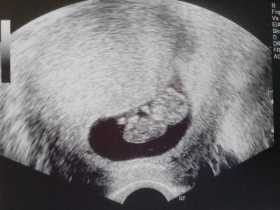 Bild zu Darf ich noch mitfahren? - Forum für Januar - Mamis