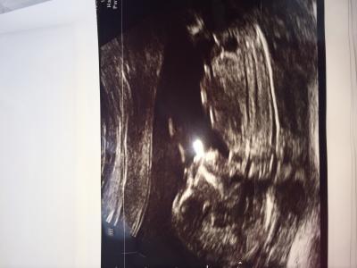 Bild zu Schöne Nachrichten NT Messung - Forum für Januar - Mamis