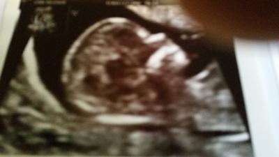 Bild zu Neue Bilder :) - Forum für Januar - Mamis