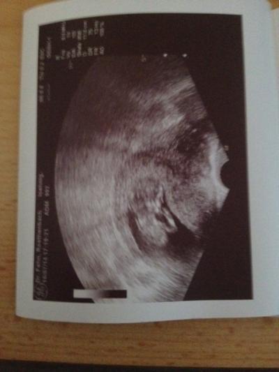 Bild zu Zurück vom FA - Forum für Januar - Mamis