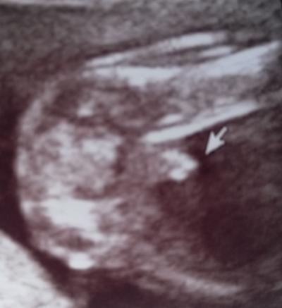 Bild zu FA Termin vom Dienstag - Forum für Januar - Mamis