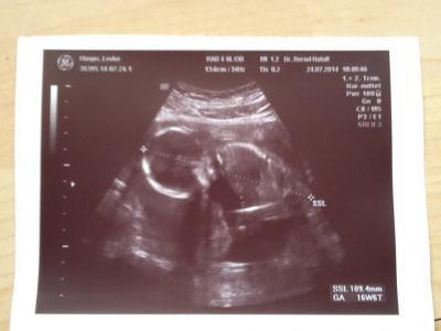 Bild zu Ich auch - Forum für Januar - Mamis
