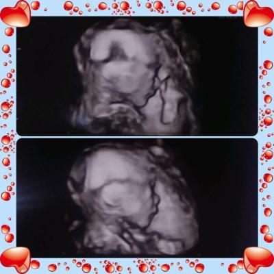 Bild zu zurück von der Feindiagnostik - Forum für Januar - Mamis