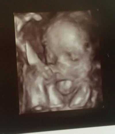 Bild zu Super Empfang, also gibts Bilder :) - Forum für Januar - Mamis