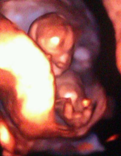 Bild zu hallo frage - Forum für Januar - Mamis