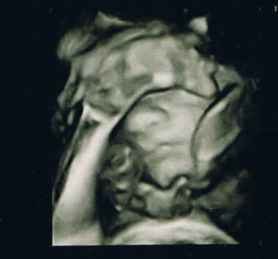 Bild zu Kuckuck, wer findet mich? - Forum für Januar - Mamis