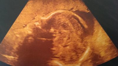 Bild zu verunsichert wegen us-Bild - Forum für Januar - Mamis