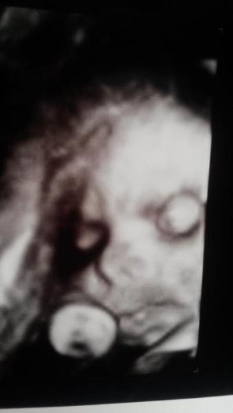 Bild zu zurück vom 3. Screening - Forum für Januar - Mamis