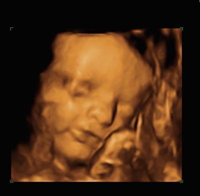 Bild zu heute wieder Termin gehabt + Bild - Forum für Januar - Mamis