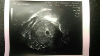 Bild zu Auch vom FA zurück - Forum für Januar - Mamis
