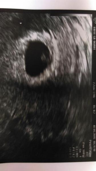 Bild zu Zurück vom FA! - Forum für Januar - Mamis