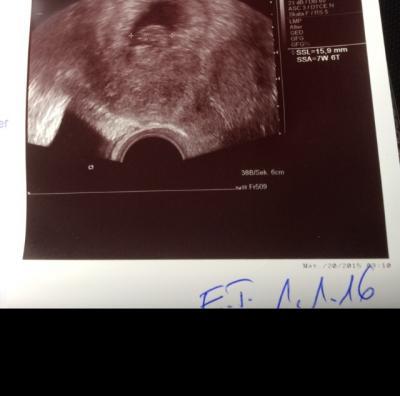 Bild zu Ganz viel Viren für mein Lieschen!!! - Forum für Januar - Mamis