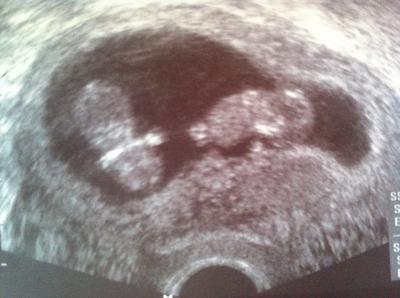 Bild zu Baby TV - Schock und Überraschung - Forum für Januar - Mamis