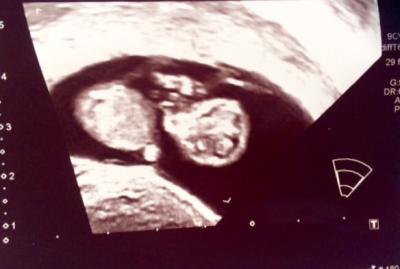 Bild zu 😍 das kleine Wunder wächst und ist putzmunter 😍 - Forum für Januar - Mamis