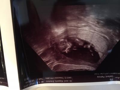 Bild zu großer Ultraschall & vorsichtiges Outing - Forum für Januar - Mamis