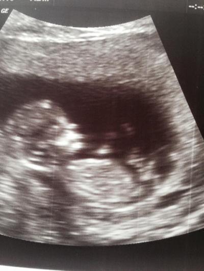 Bild zu Zurück vom FA und Hebamme kennengelernt - Forum für Januar - Mamis