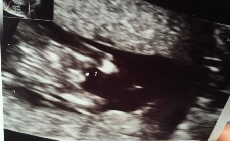 Bild zu Geschlecht 13. Ssw - Forum für Januar - Mamis