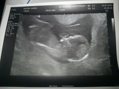 Bild zu Heute wieder Baby TV sehen dürfen - Forum für Januar - Mamis