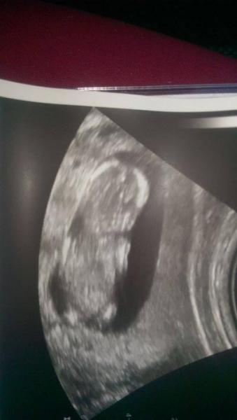 Bild zu Baby-Tv - Forum für Januar - Mamis
