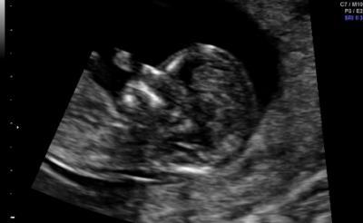 Bild zu wiedermal melden - Forum für Januar - Mamis