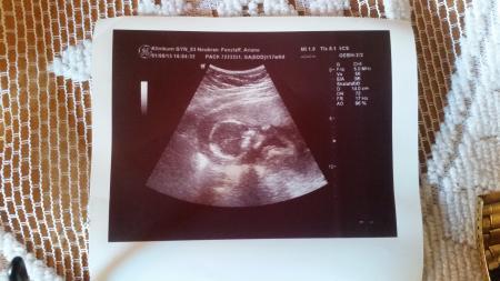 Bild zu Im kh gewesen - Forum für Januar - Mamis