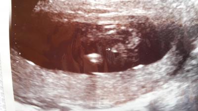Bild zu zurück vom Fa +outing - Forum für Januar - Mamis